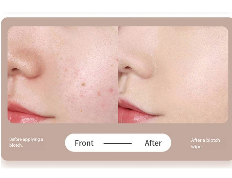 Beauty Device For Removing Blemishes Dual Lights 9 Adjustable levels