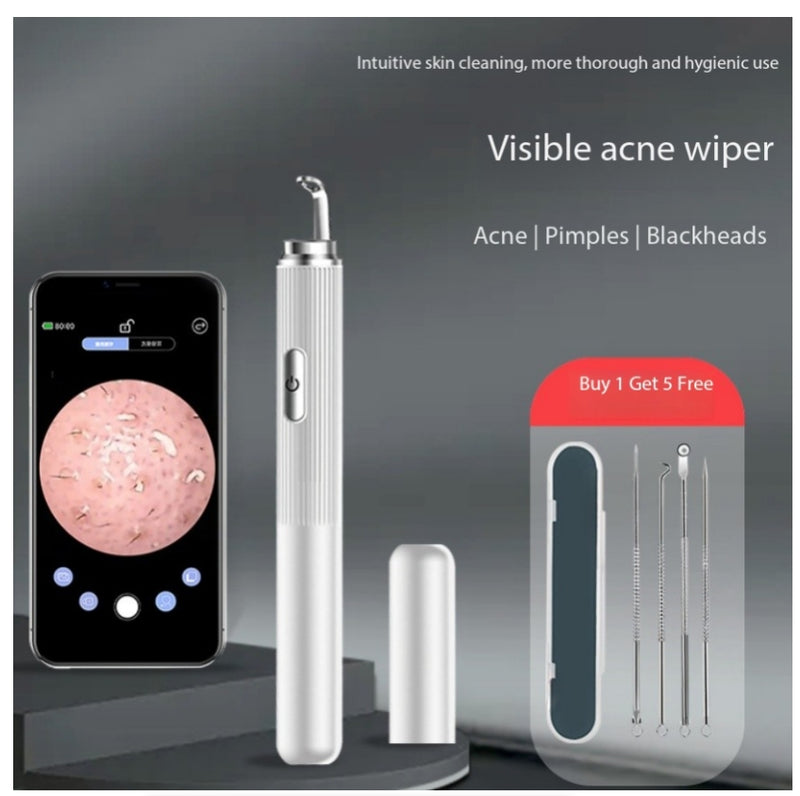 Facial Blackhead Cleansing Device With 50x High-Definition Magnification