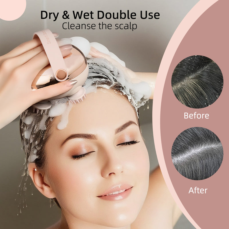 Electric Scalp Massager, 360° Rotating Kneading,